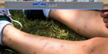 “الناموس” يهدد سكان السعيدية وتوقف المكافحة يغضب الزوار