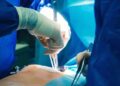 أغرب عملية في تاريخ الطب..قلوب قرود وخنازير في صدور البشر!