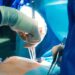 أغرب عملية في تاريخ الطب..قلوب قرود وخنازير في صدور البشر!